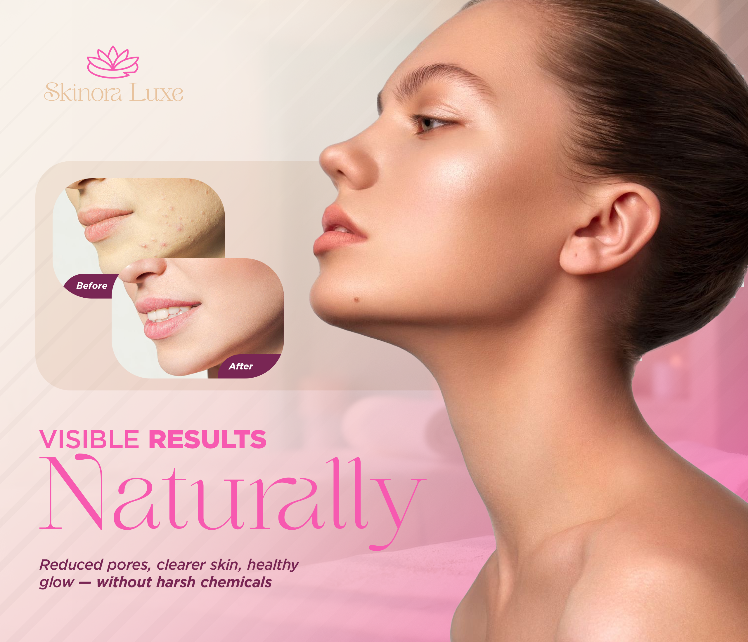 SKINORA LUXE Dead Sea Mud Mask – Facial Mask for Pores and Blackheads – Mud Mask for Face and Body – Blackhead Remover Mask and Pore Reducer – 7 oz Detox Mineral Clay